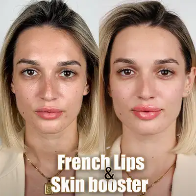 French-techniques1.webp