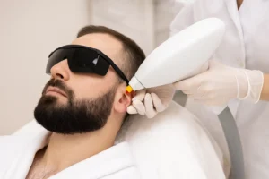 Laser Ear Hair Removal for Men