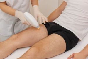 Laser Hair Removal Upper Legs for Men in Dubai