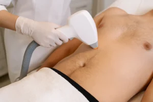 Laser Hair Removal on Stomach for Men in Dubai