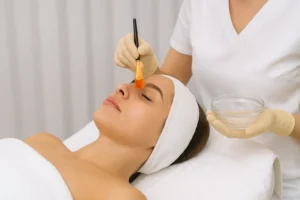 التقشير الكيميائي في أبوظبي