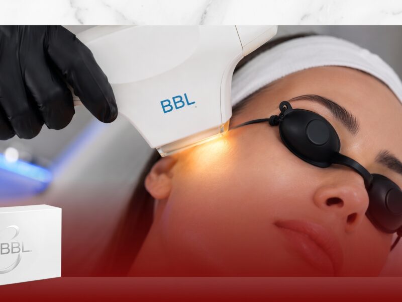 BBL Hero Facial Treatment in Dubai & Abu Dhabi at Charisma medical group